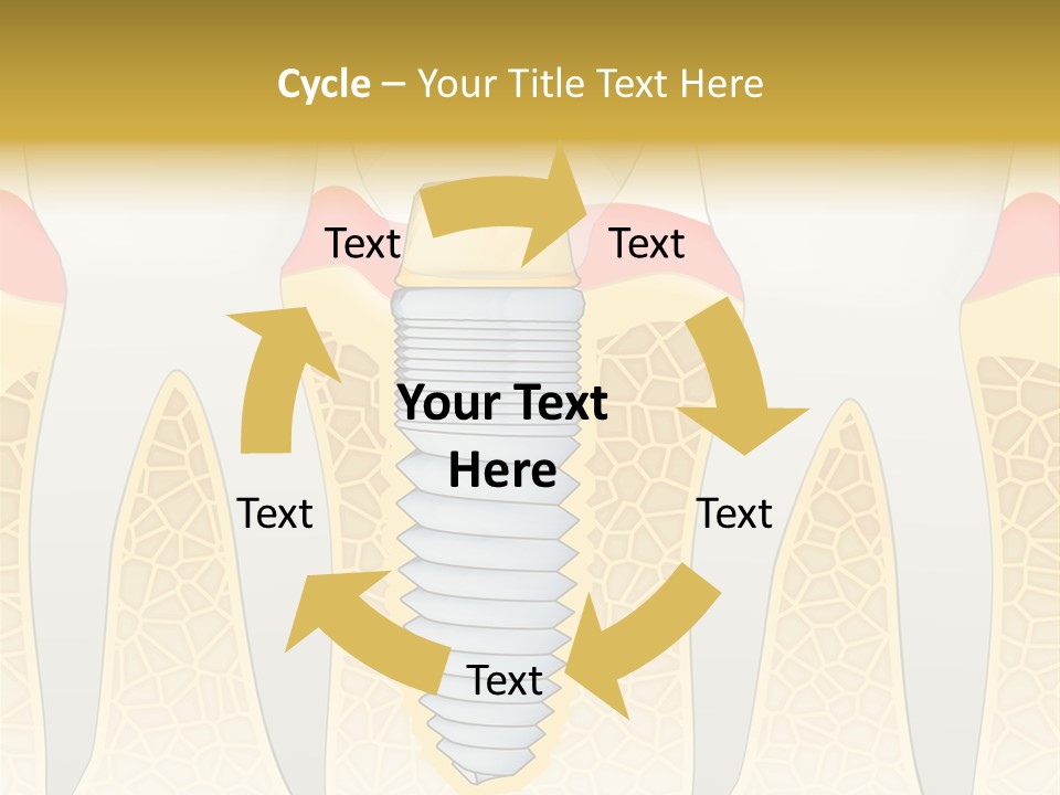 Care Clinic Implantation PowerPoint Template