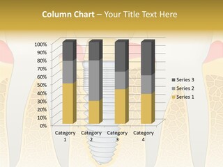 Care Clinic Implantation PowerPoint Template