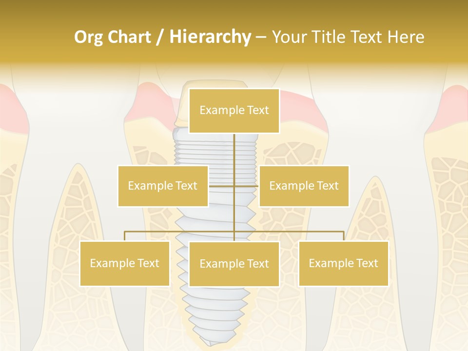 Care Clinic Implantation PowerPoint Template