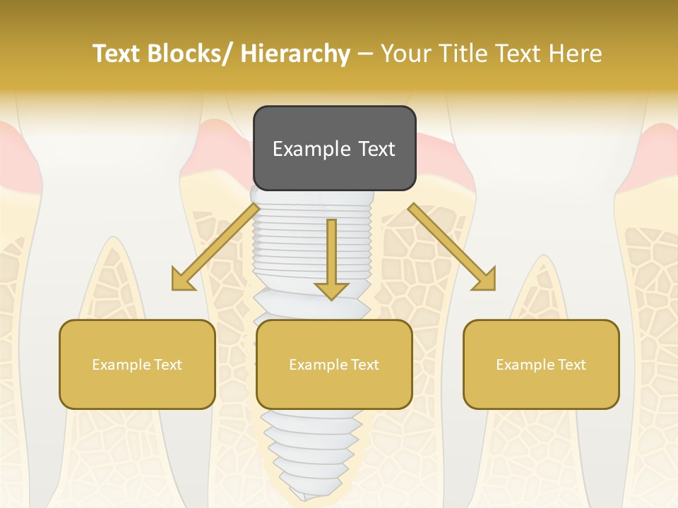Care Clinic Implantation PowerPoint Template