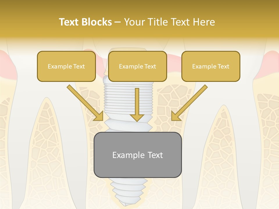 Care Clinic Implantation PowerPoint Template