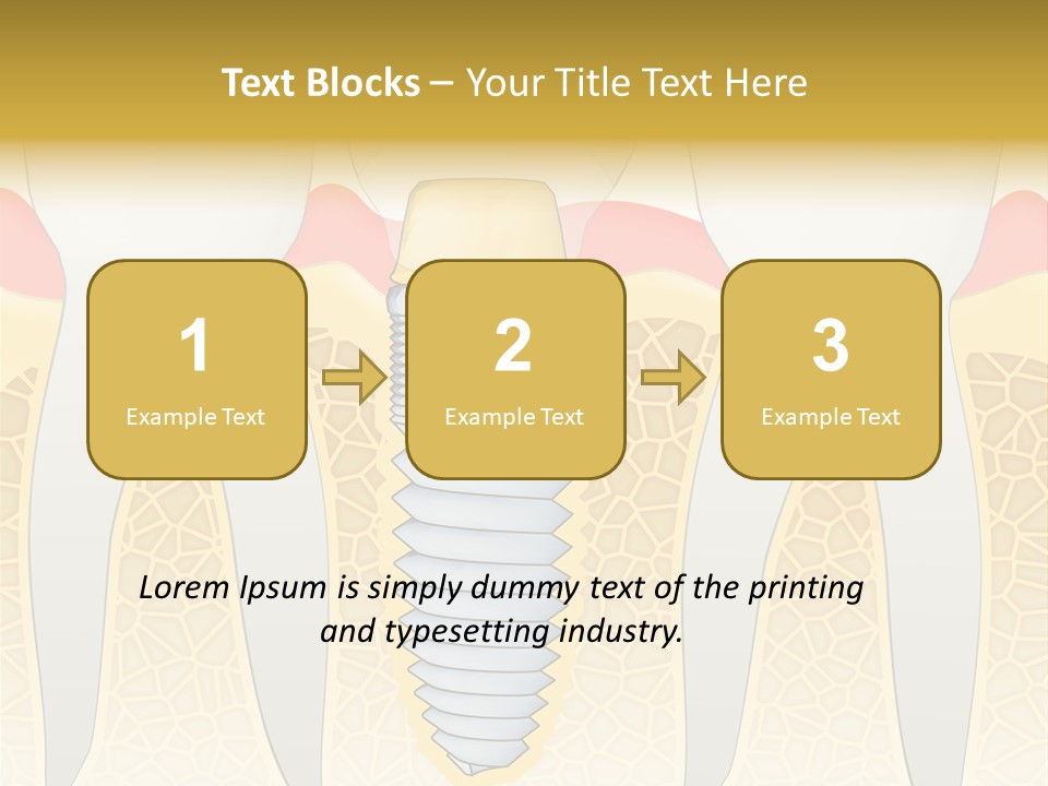 Care Clinic Implantation PowerPoint Template