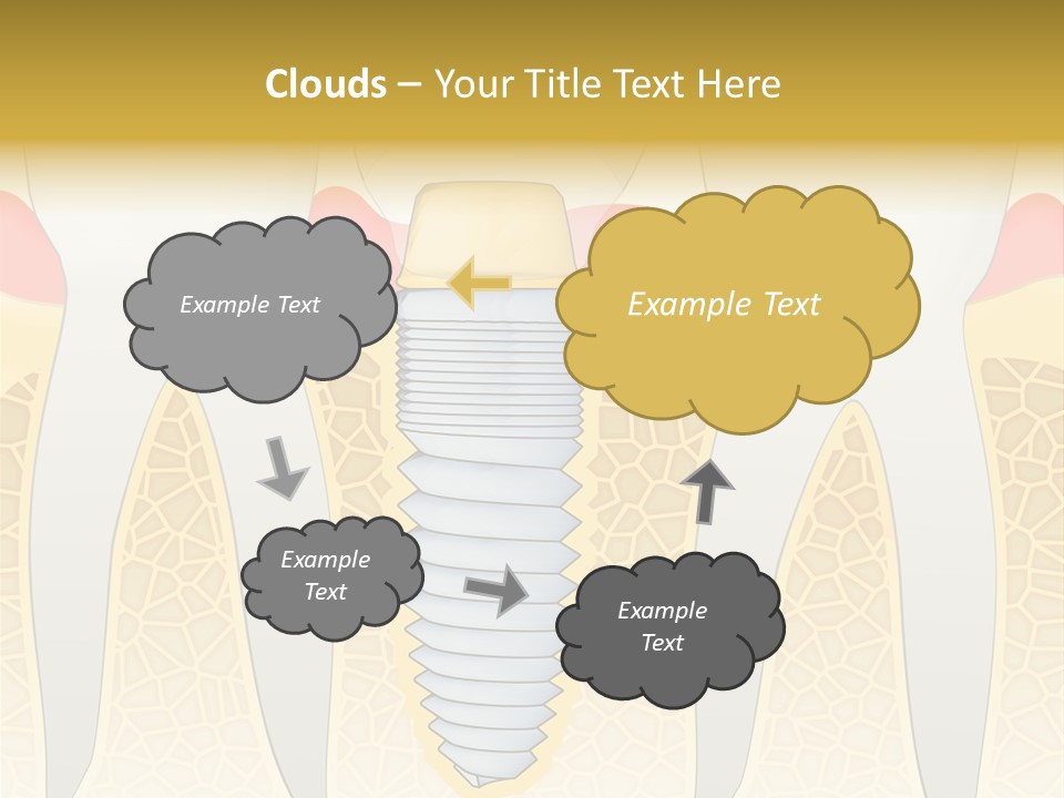 Care Clinic Implantation PowerPoint Template