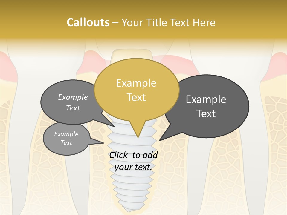 Care Clinic Implantation PowerPoint Template