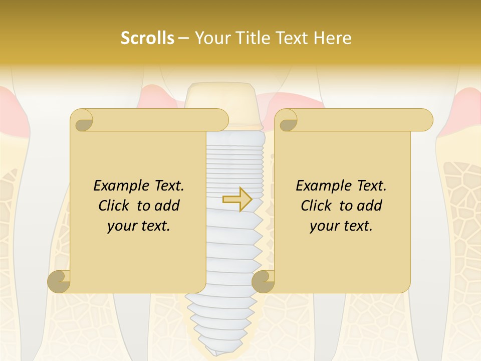 Care Clinic Implantation PowerPoint Template