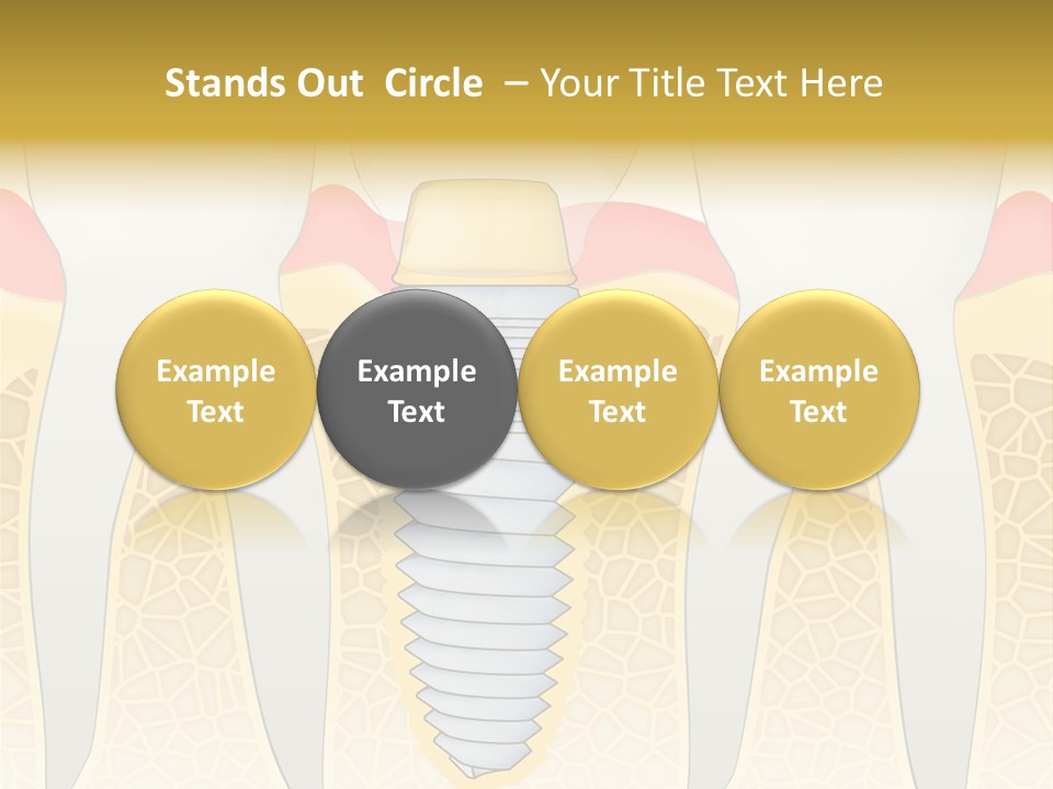 Care Clinic Implantation PowerPoint Template