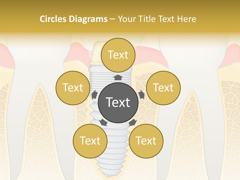 Care Clinic Implantation PowerPoint Template