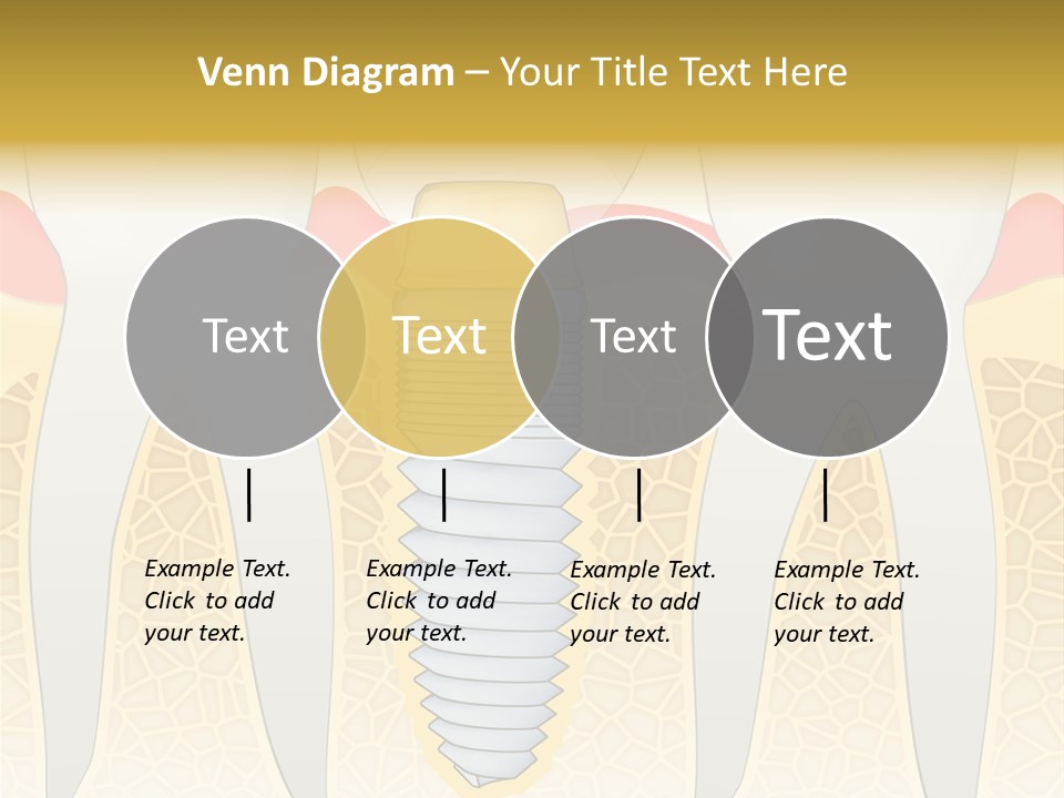 Care Clinic Implantation PowerPoint Template