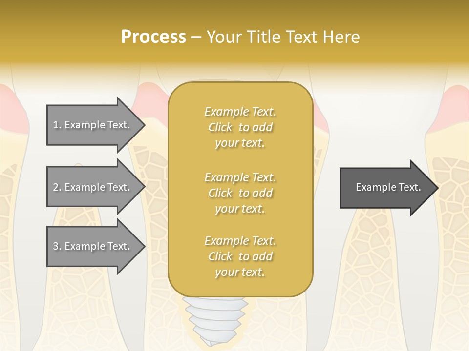 Care Clinic Implantation PowerPoint Template