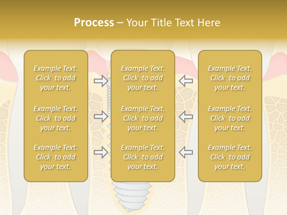 Care Clinic Implantation PowerPoint Template