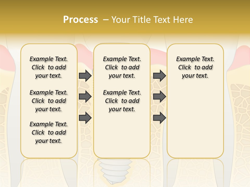 Care Clinic Implantation PowerPoint Template