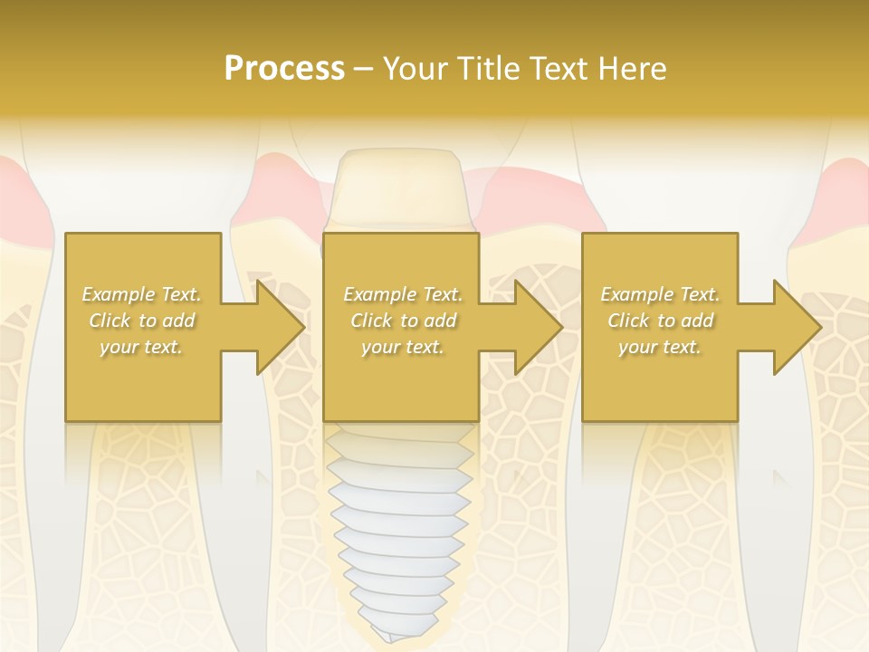 Care Clinic Implantation PowerPoint Template