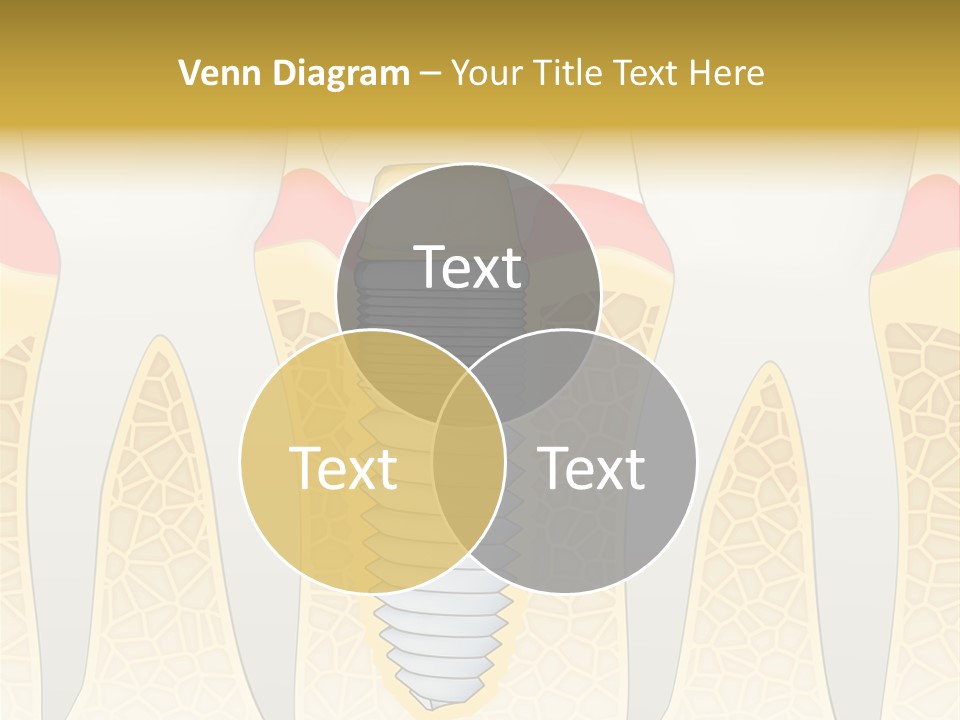 Care Clinic Implantation PowerPoint Template