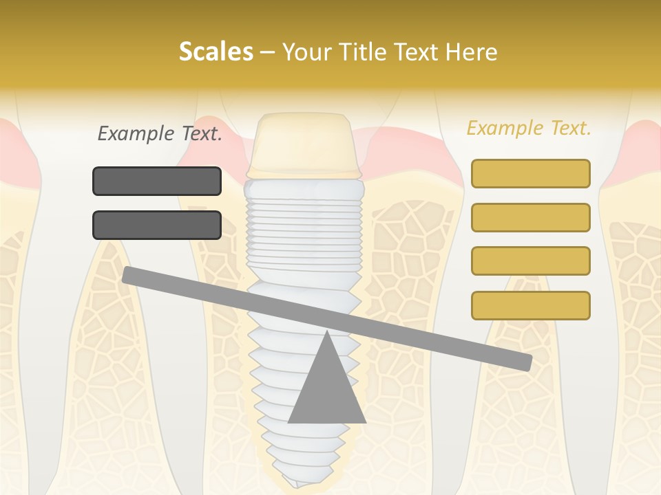 Care Clinic Implantation PowerPoint Template