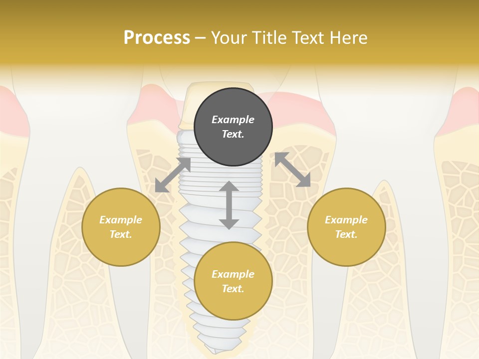 Care Clinic Implantation PowerPoint Template