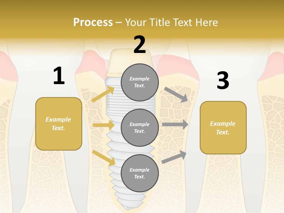 Care Clinic Implantation PowerPoint Template