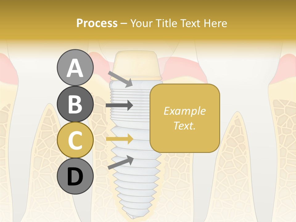 Care Clinic Implantation PowerPoint Template