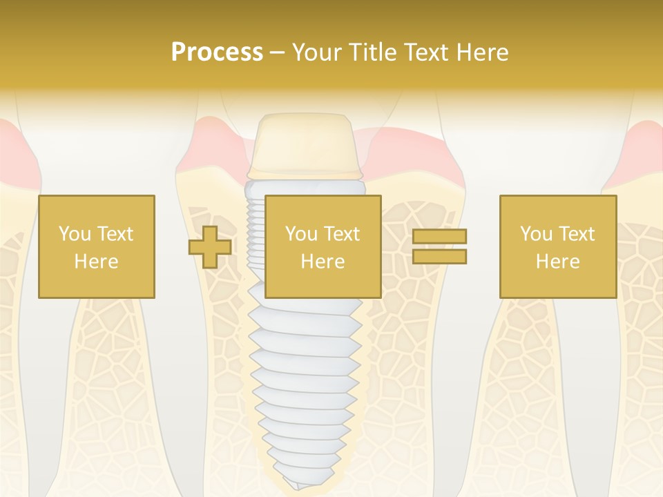 Care Clinic Implantation PowerPoint Template