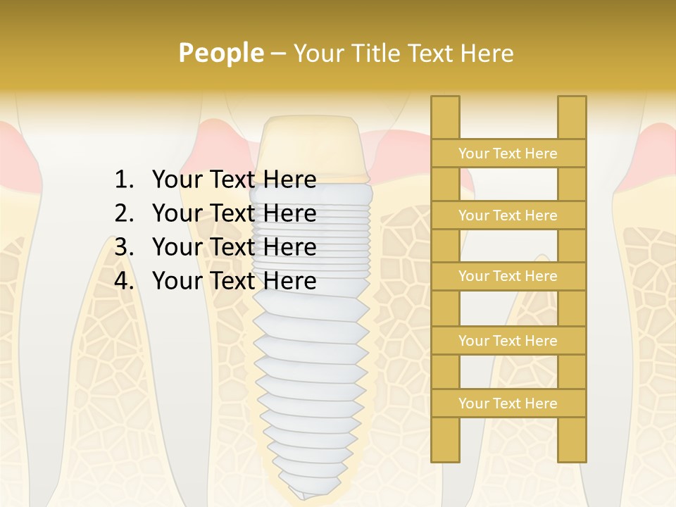 Care Clinic Implantation PowerPoint Template