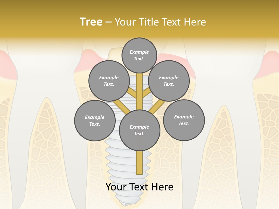 Care Clinic Implantation PowerPoint Template