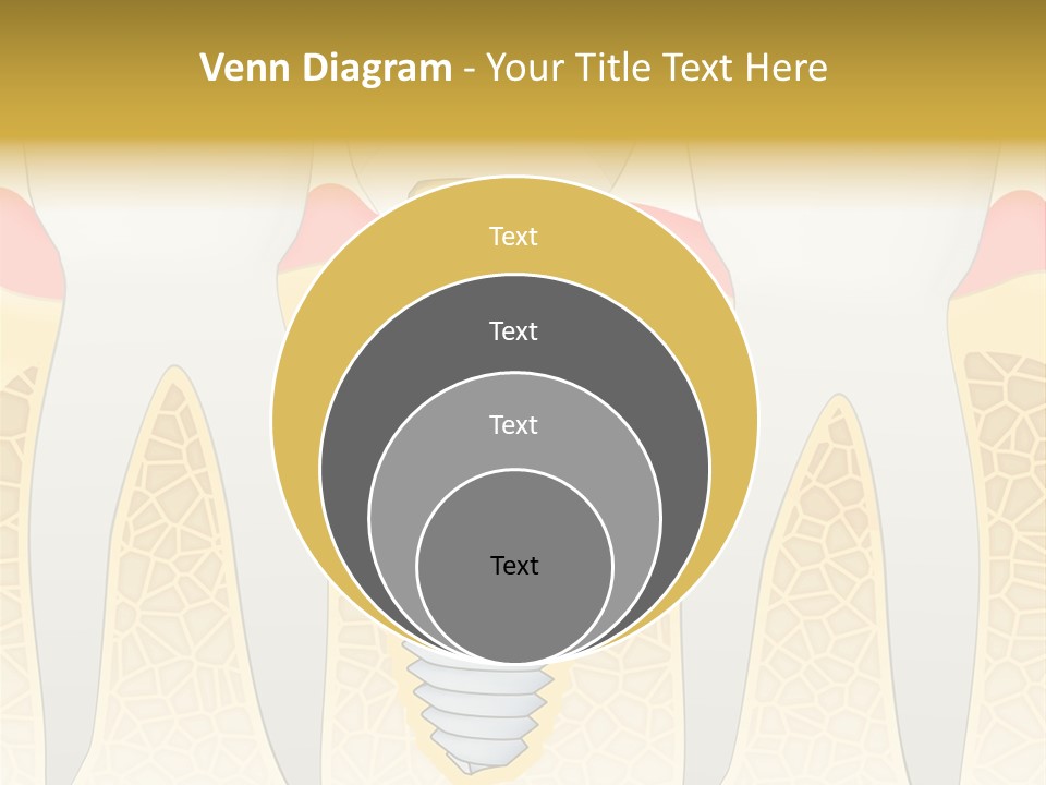 Care Clinic Implantation PowerPoint Template