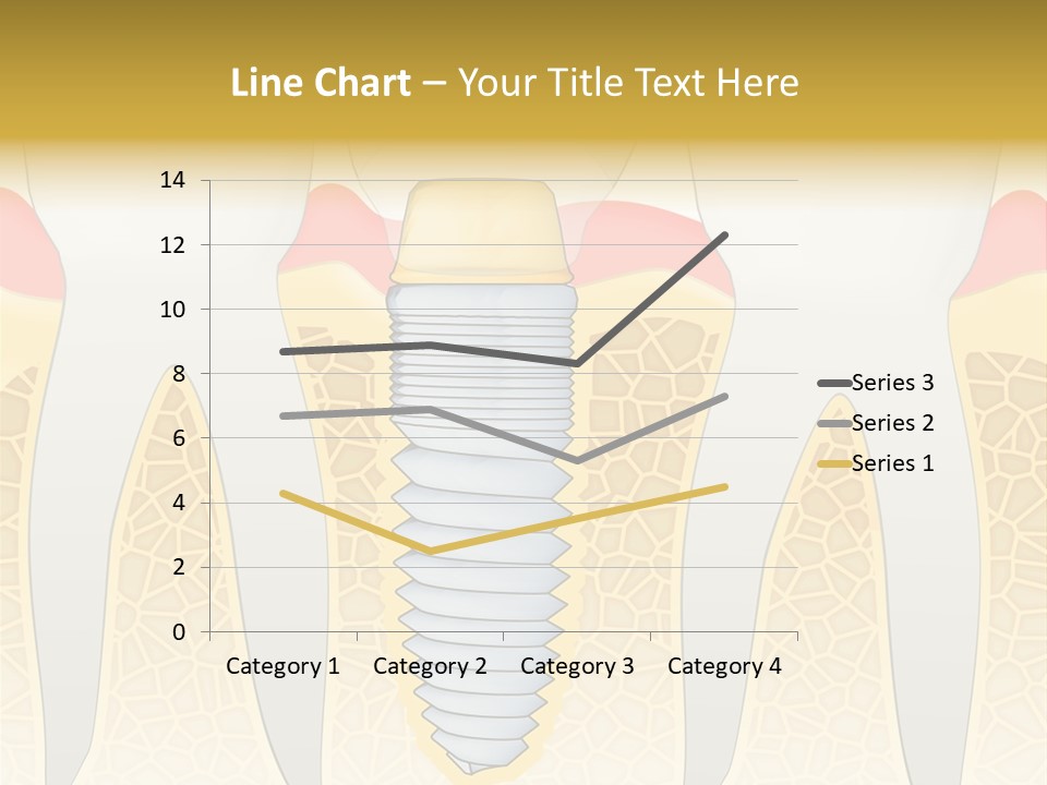 Care Clinic Implantation PowerPoint Template