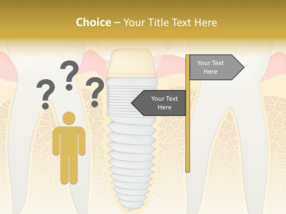 Care Clinic Implantation PowerPoint Template