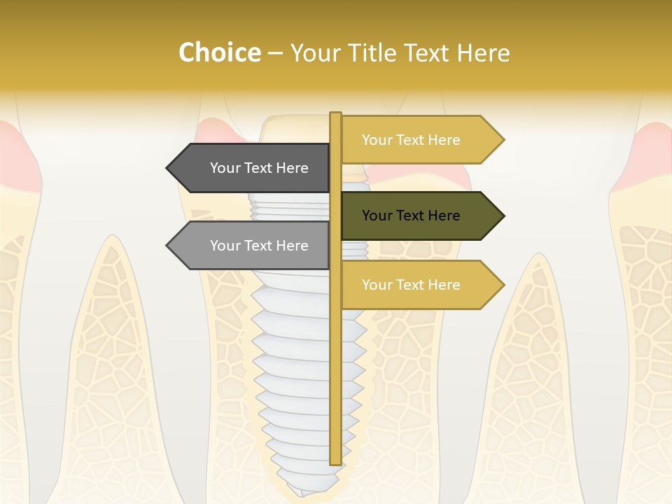 Care Clinic Implantation PowerPoint Template