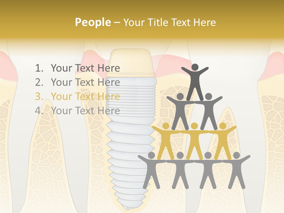 Care Clinic Implantation PowerPoint Template