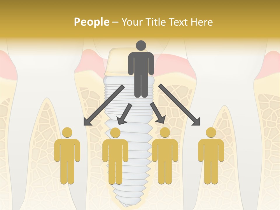 Care Clinic Implantation PowerPoint Template