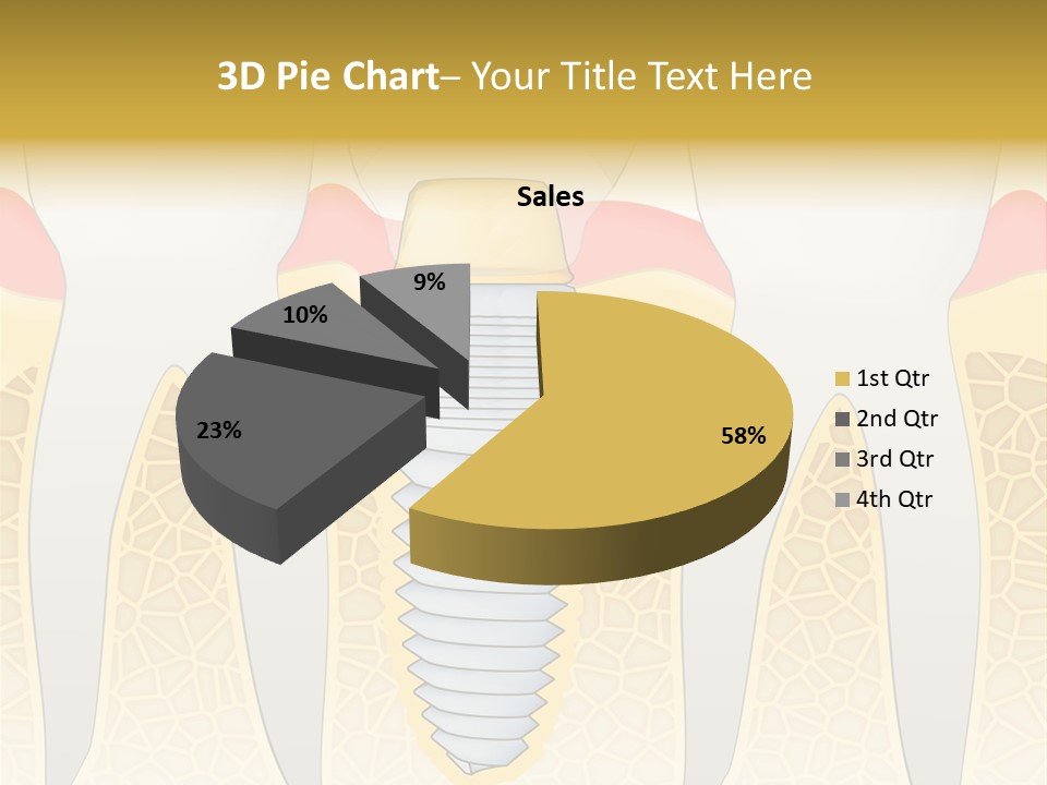Care Clinic Implantation PowerPoint Template