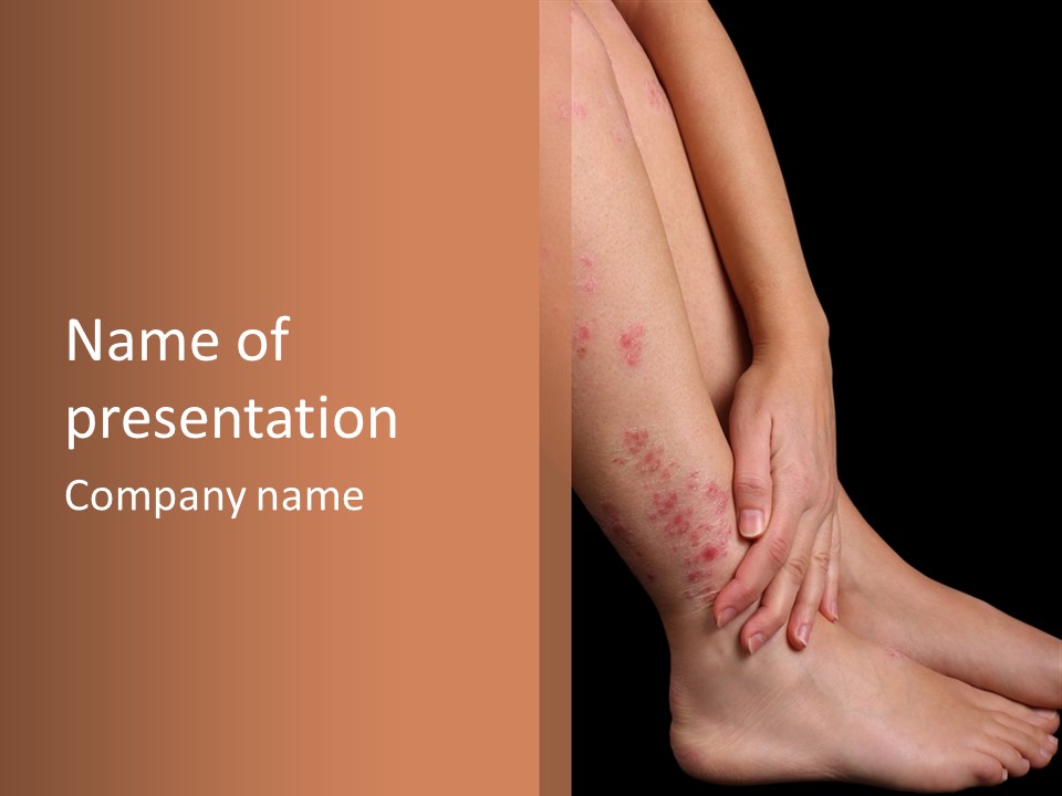 Skin Peeling Skin Condition PowerPoint Template