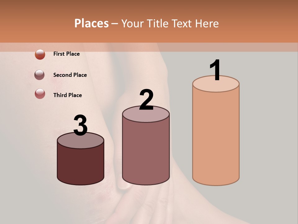 Skin Peeling Skin Condition PowerPoint Template