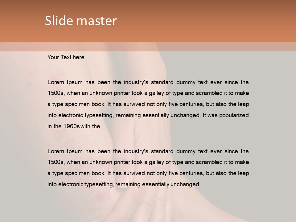 Skin Peeling Skin Condition PowerPoint Template