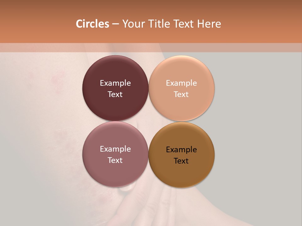 Skin Peeling Skin Condition PowerPoint Template