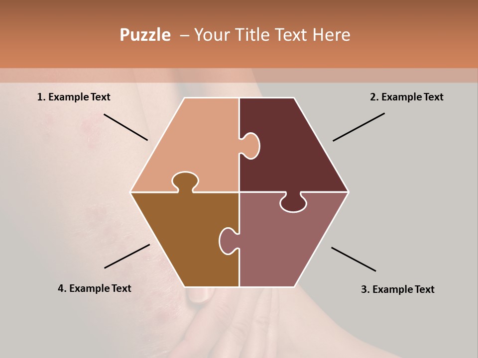 Skin Peeling Skin Condition PowerPoint Template