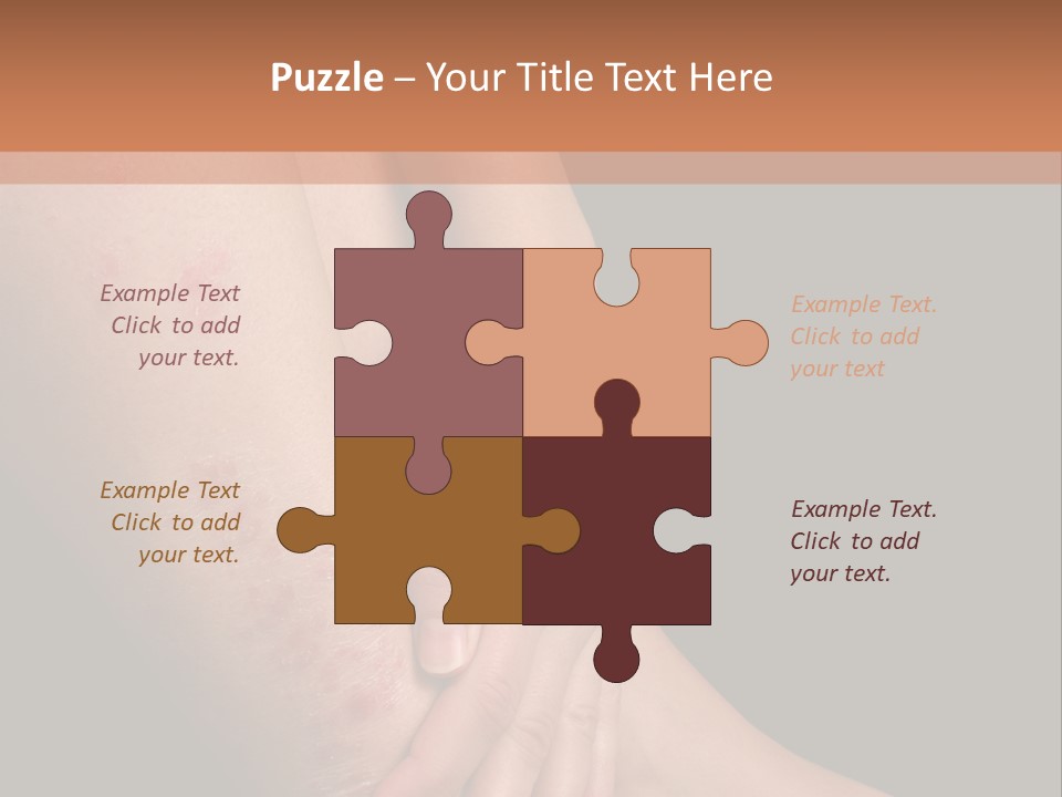 Skin Peeling Skin Condition PowerPoint Template