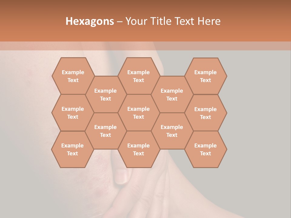 Skin Peeling Skin Condition PowerPoint Template