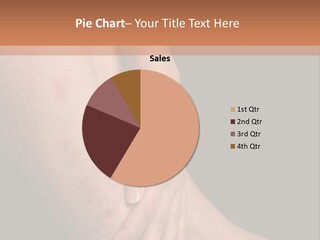 Skin Peeling Skin Condition PowerPoint Template