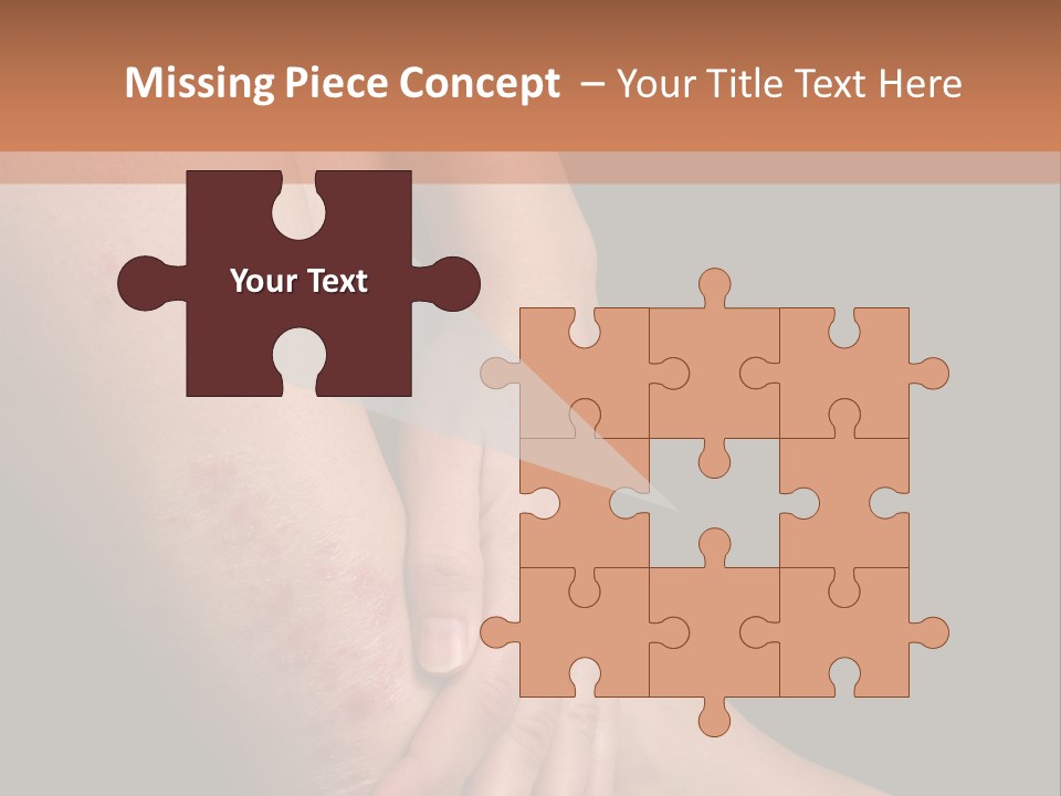 Skin Peeling Skin Condition PowerPoint Template