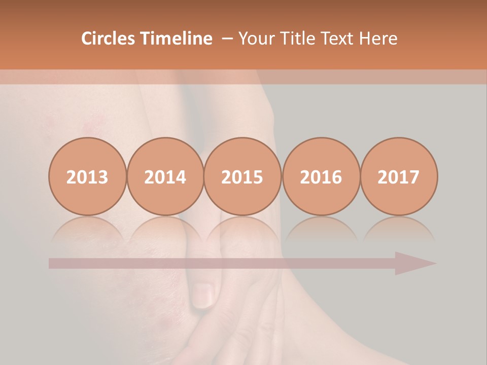 Skin Peeling Skin Condition PowerPoint Template