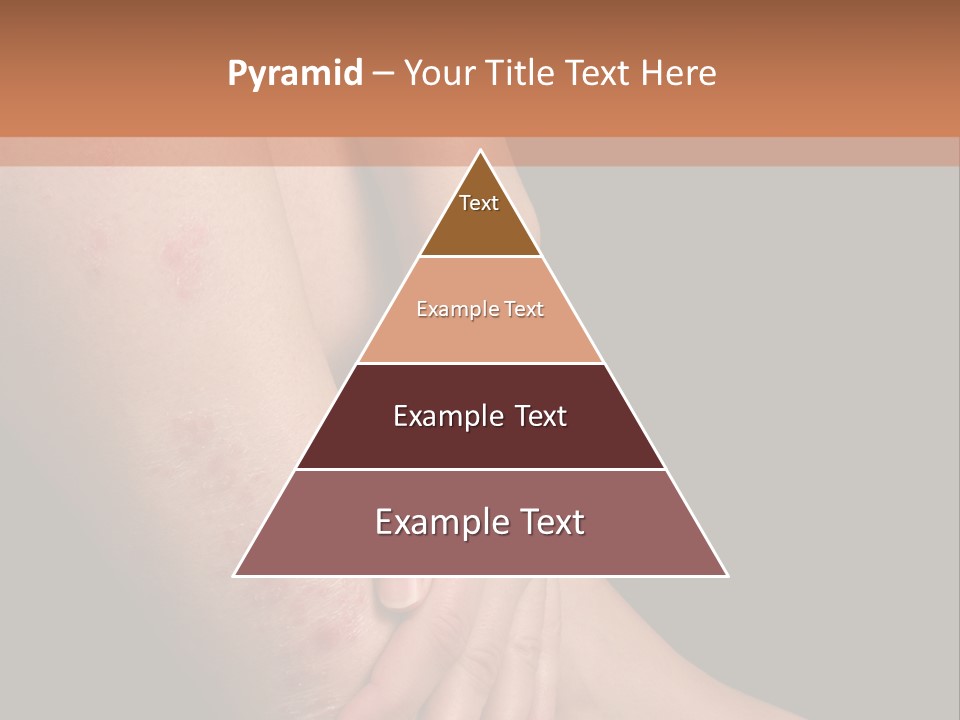 Skin Peeling Skin Condition PowerPoint Template