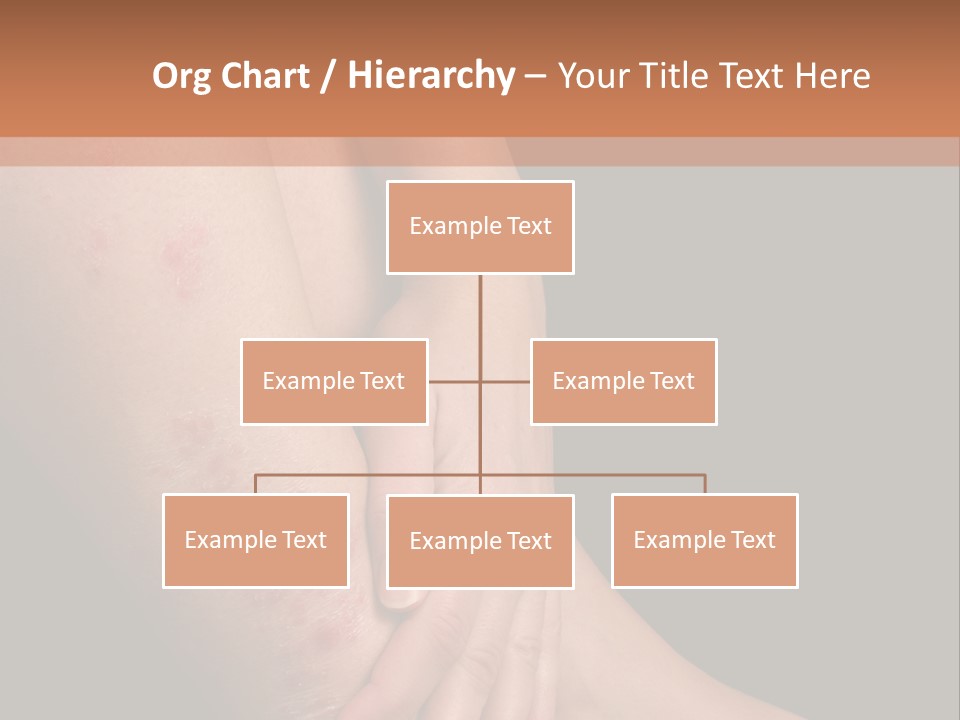 Skin Peeling Skin Condition PowerPoint Template