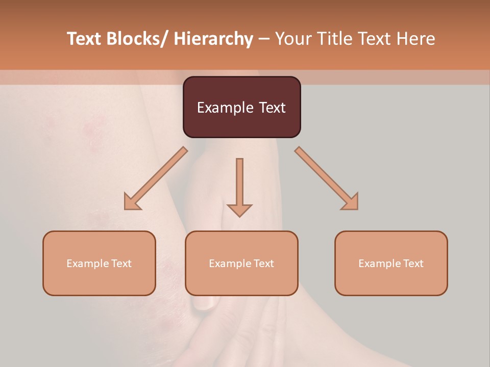 Skin Peeling Skin Condition PowerPoint Template