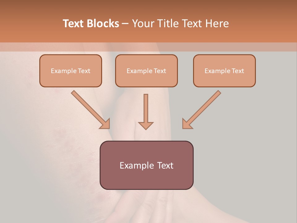 Skin Peeling Skin Condition PowerPoint Template