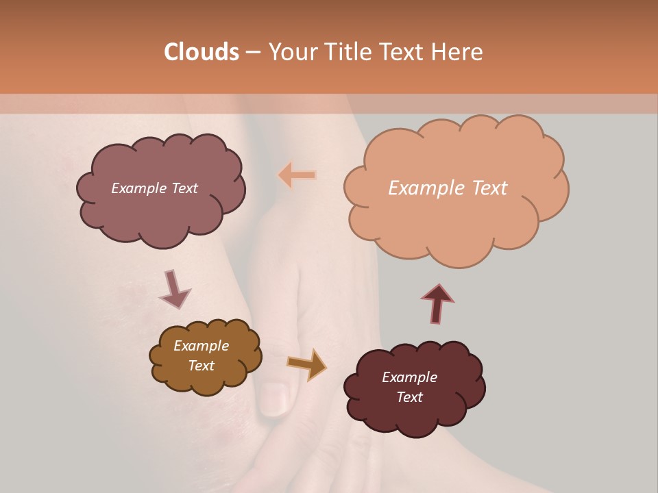 Skin Peeling Skin Condition PowerPoint Template