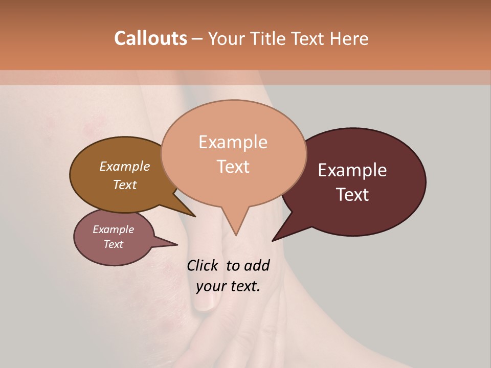 Skin Peeling Skin Condition PowerPoint Template