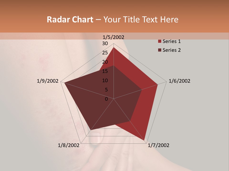 Skin Peeling Skin Condition PowerPoint Template