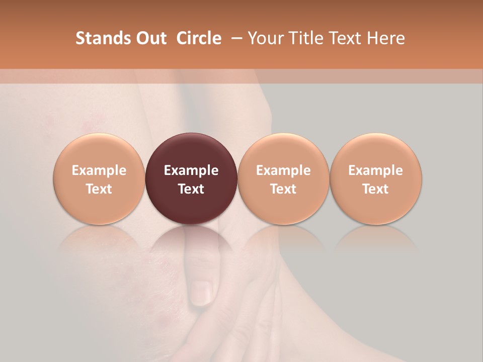 Skin Peeling Skin Condition PowerPoint Template