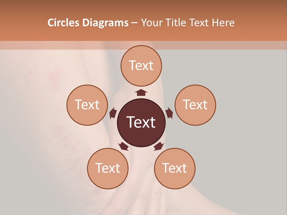 Skin Peeling Skin Condition PowerPoint Template